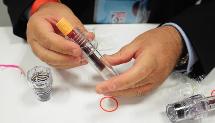 اختبار منشطات