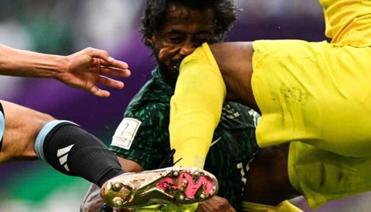 إصابة ياسر الشهراني